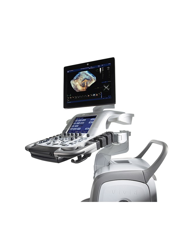 GE Vivid E9 Ultrasound System